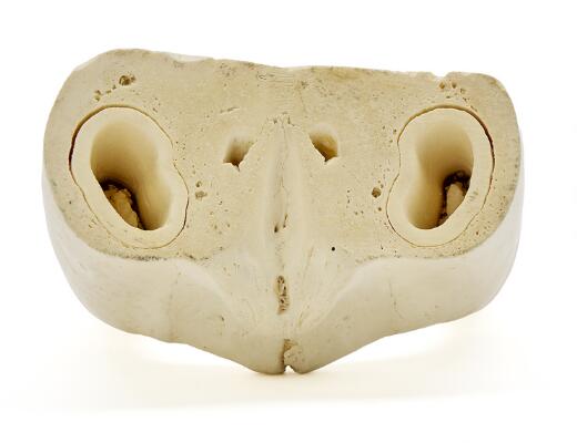 4. billede ud af i alt 4